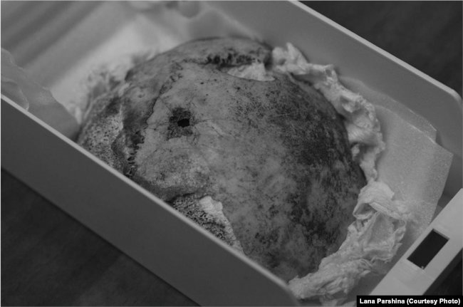 Принадлежит ли этот фрагмент черепа Гитлеру?